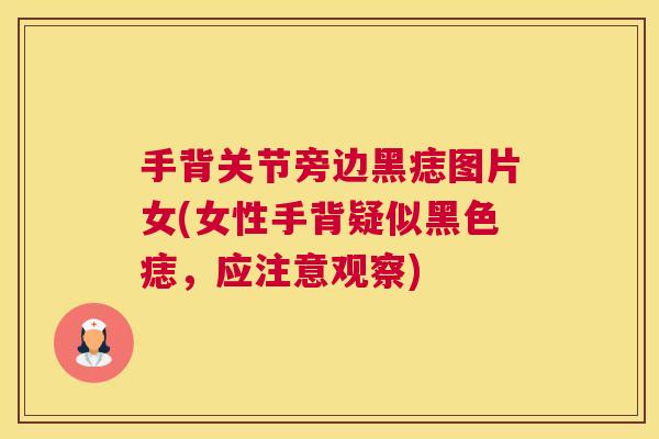 手背关节旁边黑痣图片女(女性手背疑似黑色痣，应注意观察)