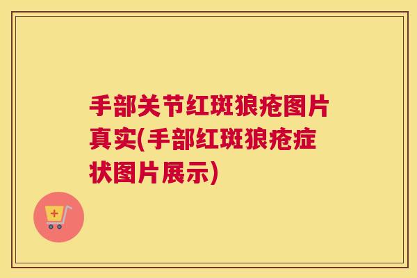 手部关节红斑狼疮图片真实(手部红斑狼疮症状图片展示)