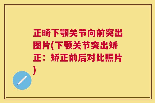 正畸下颚关节向前突出图片(下颚关节突出矫正：矫正前后对比照片)