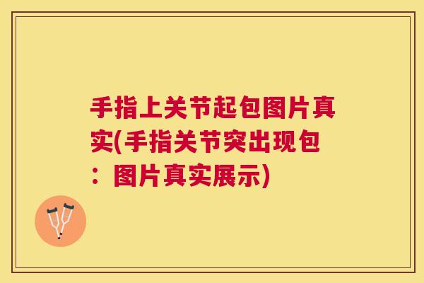 手指上关节起包图片真实(手指关节突出现包：图片真实展示)