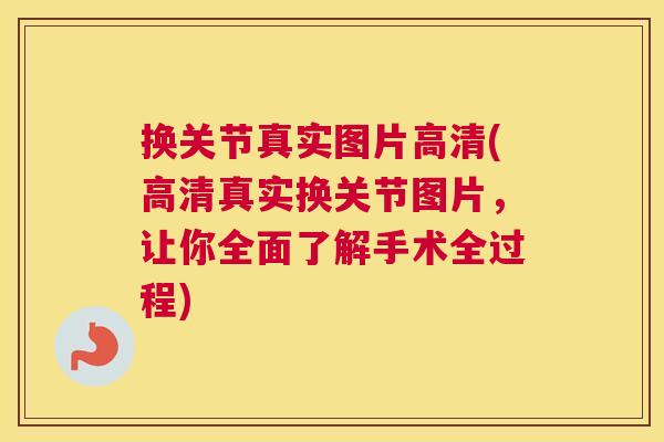 换关节真实图片高清(高清真实换关节图片，让你全面了解手术全过程)