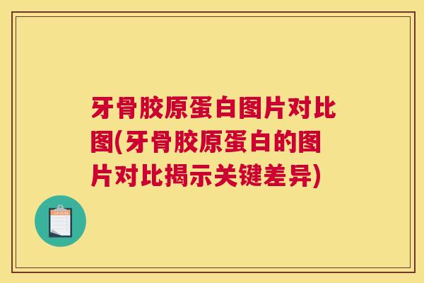 牙骨胶原蛋白图片对比图(牙骨胶原蛋白的图片对比揭示关键差异)