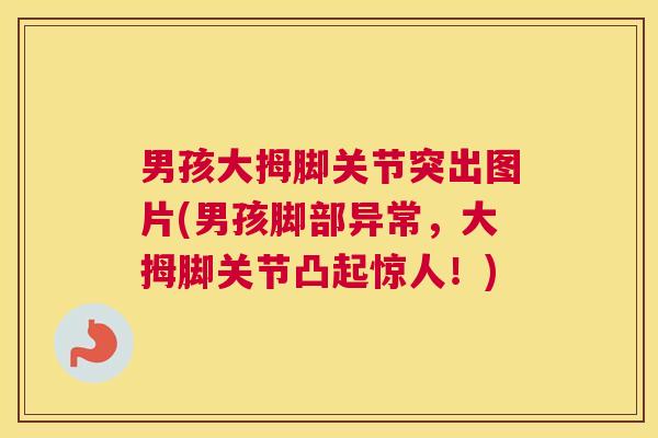 男孩大拇脚关节突出图片(男孩脚部异常，大拇脚关节凸起惊人！)