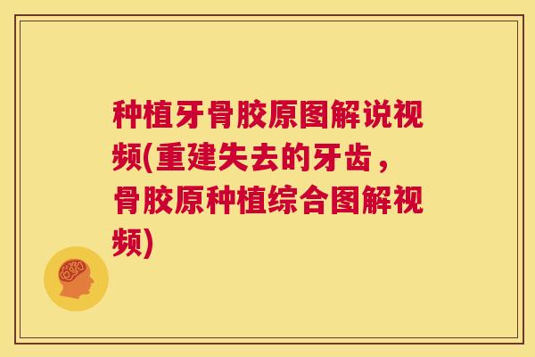 种植牙骨胶原图解说视频(重建失去的牙齿，骨胶原种植综合图解视频)