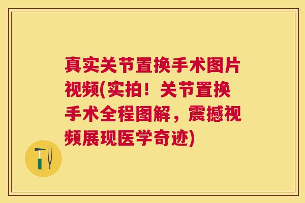 真实关节置换手术图片视频(实拍！关节置换手术全程图解，震撼视频展现医学奇迹)