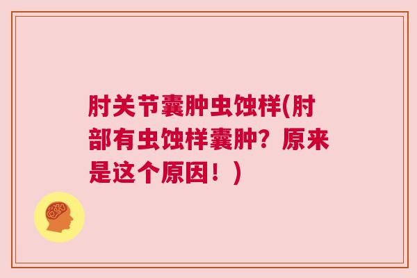 肘关节囊肿虫蚀样(肘部有虫蚀样囊肿？原来是这个原因！)