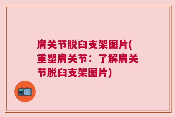 肩关节脱臼支架图片(重塑肩关节：了解肩关节脱臼支架图片)