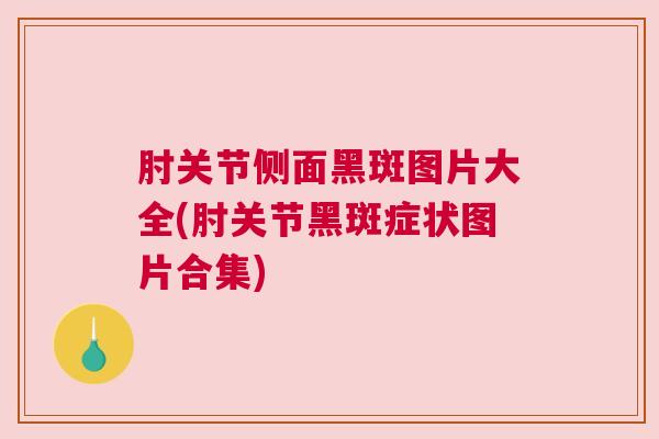 肘关节侧面黑斑图片大全(肘关节黑斑症状图片合集)