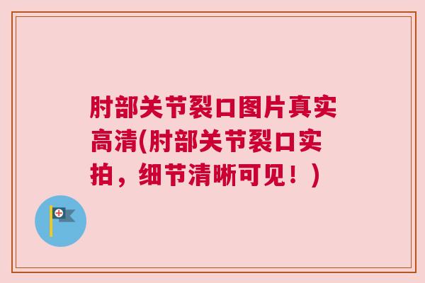 肘部关节裂口图片真实高清(肘部关节裂口实拍，细节清晰可见！)