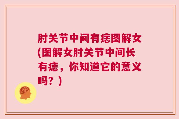 肘关节中间有痣图解女(图解女肘关节中间长有痣，你知道它的意义吗？)
