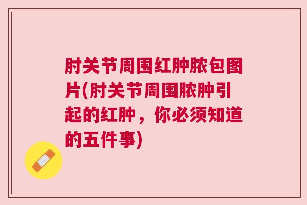 肘关节周围红肿脓包图片(肘关节周围脓肿引起的红肿，你必须知道的五件事)