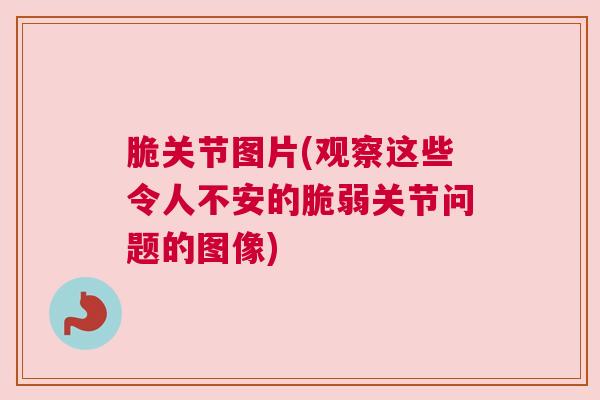 脆关节图片(观察这些令人不安的脆弱关节问题的图像)