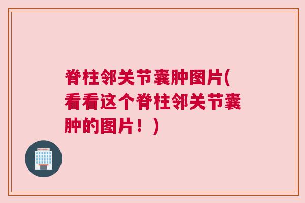 脊柱邻关节囊肿图片(看看这个脊柱邻关节囊肿的图片！)