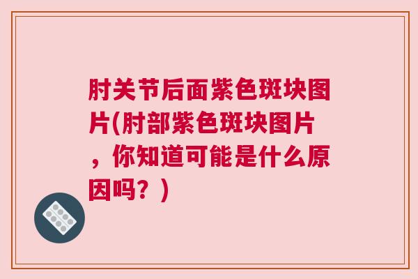 肘关节后面紫色斑块图片(肘部紫色斑块图片，你知道可能是什么原因吗？)