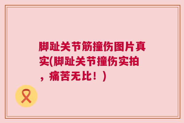 脚趾关节筋撞伤图片真实(脚趾关节撞伤实拍，痛苦无比！)