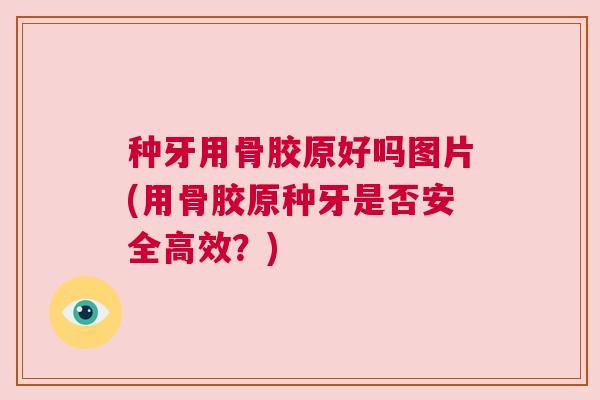 种牙用骨胶原好吗图片(用骨胶原种牙是否安全高效？)