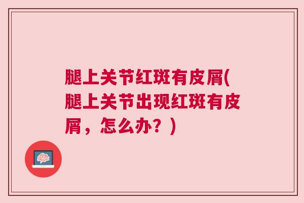 腿上关节红斑有皮屑(腿上关节出现红斑有皮屑，怎么办？)