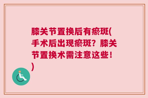 膝关节置换后有瘀斑(手术后出现瘀斑?膝关节置换术需注意这些!) 膝关节置换后有瘀斑(手术后出现瘀斑?膝关节置换术需注意这些!)