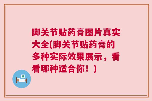 脚关节贴药膏图片真实大全(脚关节贴药膏的多种实际效果展示，看看哪种适合你！)