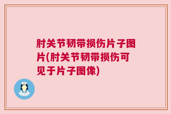 肘关节韧带损伤片子图片(肘关节韧带损伤可见于片子图像)