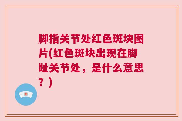 脚指关节处红色斑块图片(红色斑块出现在脚趾关节处，是什么意思？)