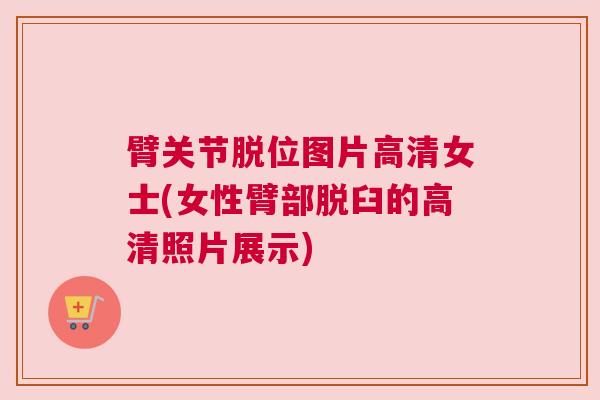 臂关节脱位图片高清女士(女性臂部脱臼的高清照片展示)