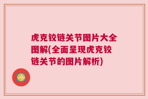 虎克铰链关节图片大全图解(全面呈现虎克铰链关节的图片解析)