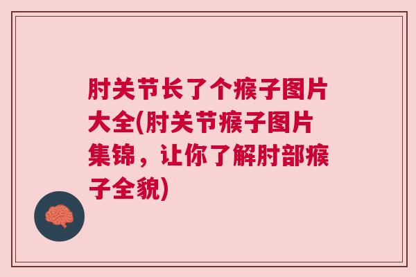 肘关节长了个瘊子图片大全(肘关节瘊子图片集锦，让你了解肘部瘊子全貌)