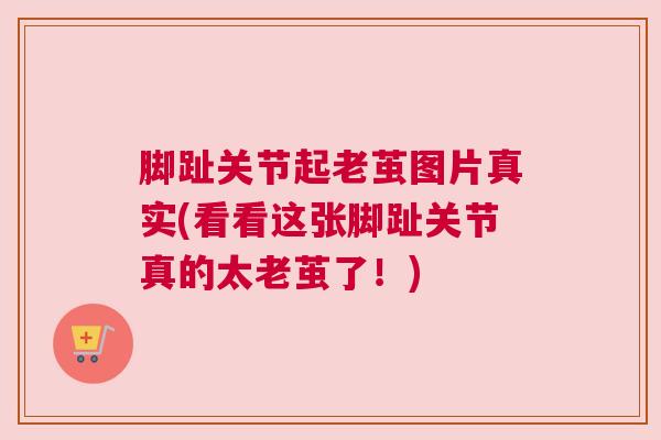 脚趾关节起老茧图片真实(看看这张脚趾关节真的太老茧了！)