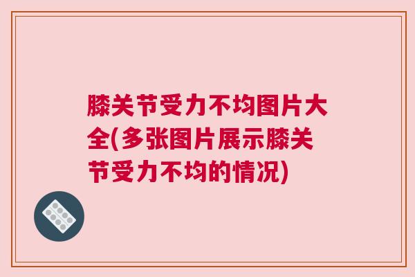 膝关节受力不均图片大全(多张图片展示膝关节受力不均的情况)